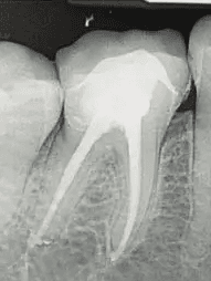 Dental x-ray, September 2025