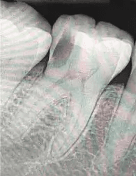 Dental x-ray, March 2025